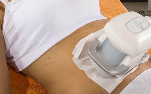 Cryolipolysis