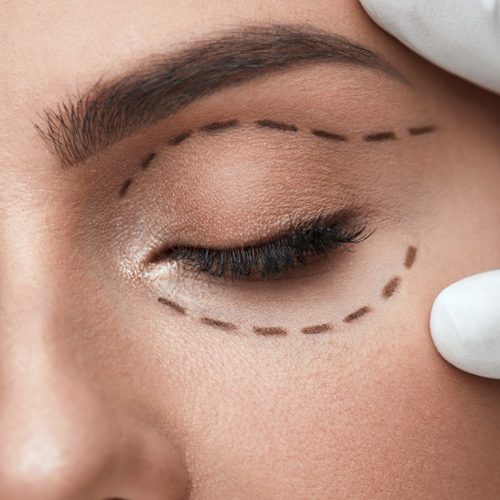 Eyelid Aesthetic Eyelid Aesthetic