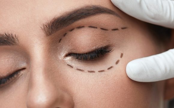 Eyelid Aesthetic
