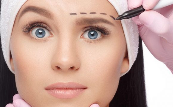 Eyebrow Lift Surgery