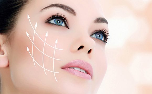 Facelift